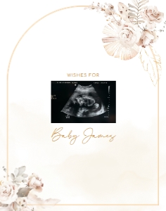 Sonogram Sign - SS-03-col-0068 (11x14): Sonogram Sign - SS-03-v-col-68