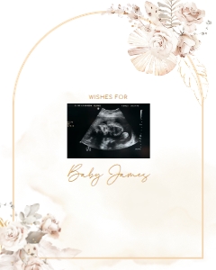 Sonogram Sign - SS-03-col-0068 (16x20): Sonogram Sign - SS-03-v-col-68