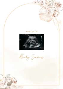 Sonogram Sign - SS-03-col-0068 (A2): Sonogram Sign - SS-03-v-col-68