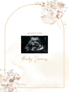 Sonogram Sign - SS-03-col-0068 (18x24): Sonogram Sign - SS-03-v-col-68