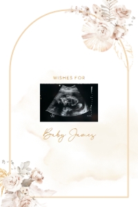 Sonogram Sign - SS-03-col-0068 (20x30): Sonogram Sign - SS-03-v-col-68