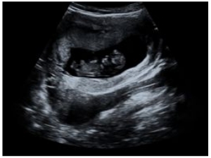 Baby Announcement Ultrasound: Baby Announcement Letter Board with Ultrasound